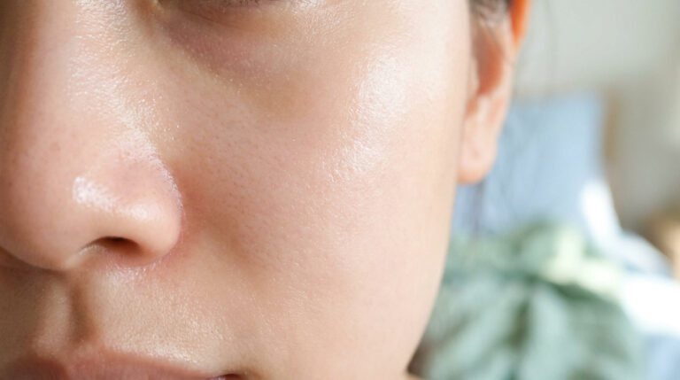 Gros plan sur une peau avec des pores visibles au niveau du nez et de la joue.